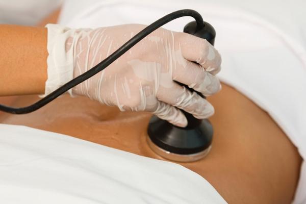 Vakuummassage und RF — Lifting — eine Kombination von Verfahren