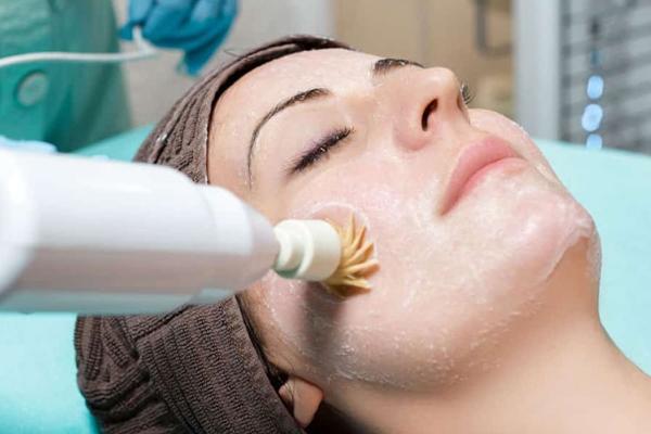 Was ist ein Facelift?